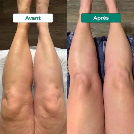 Avant après 4